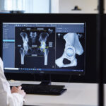 Intressanta Semcon-projekt inom produktutveckling: Luftfilter med ny design och AI-baserat operationssystem